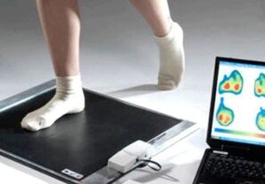 A hallux valgus diagnózisa