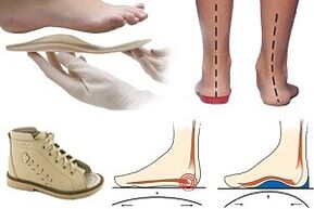 ortopéd cipő hallux valgus gyermeknél