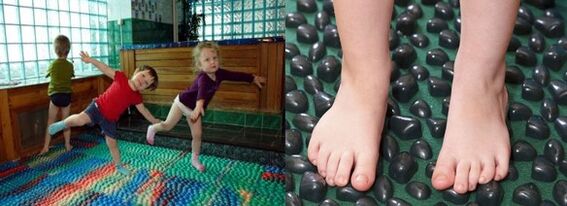 Gimnatika a valgus deformációhoz